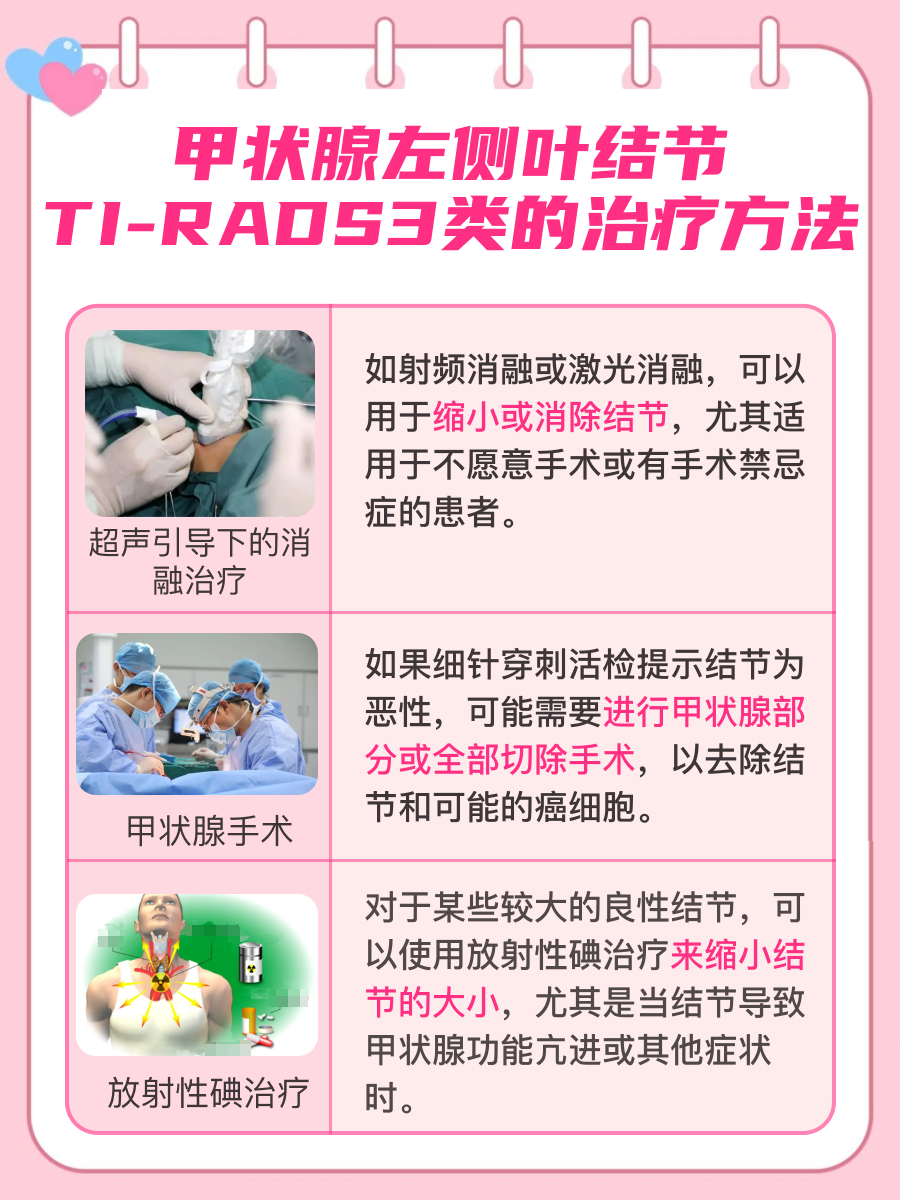 甲状腺左侧叶结节TI-RADS3类，严不严重？