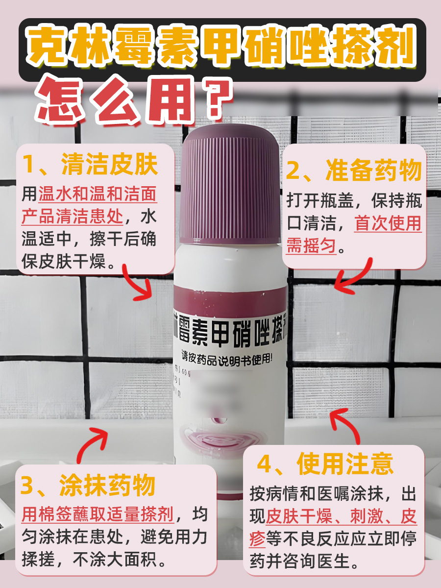 轻松get√ 克林霉素甲硝唑搽剂的使用技巧！