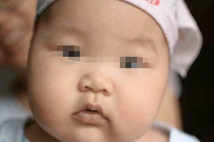宝宝塌鼻梁图