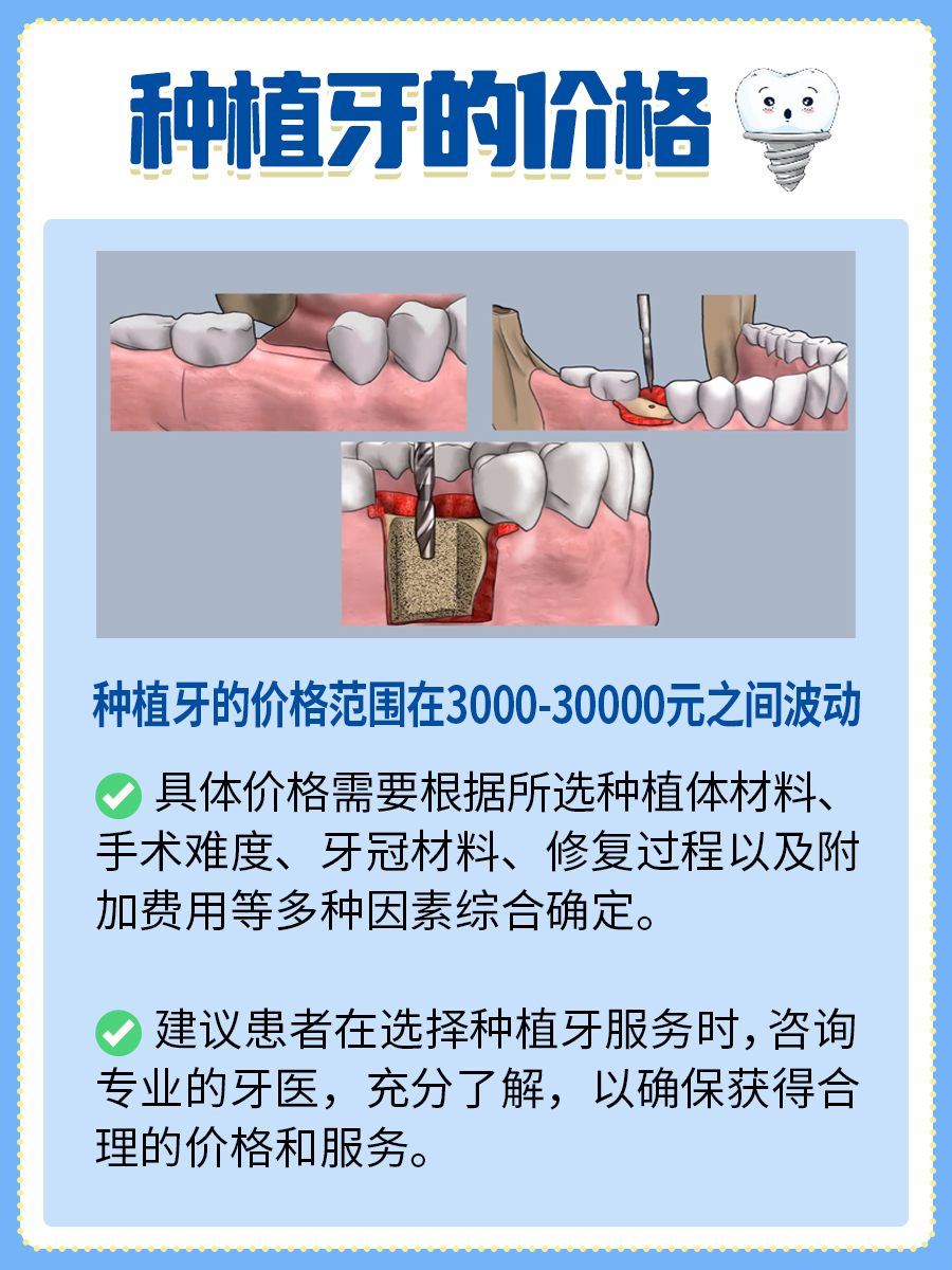 ​种牙报价全解析：了解口腔健康的投资