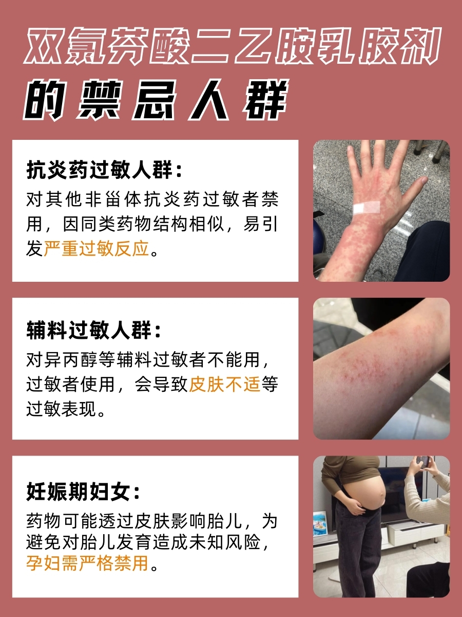 还不知？双氯芬酸二乙胺乳胶剂真面目大起底