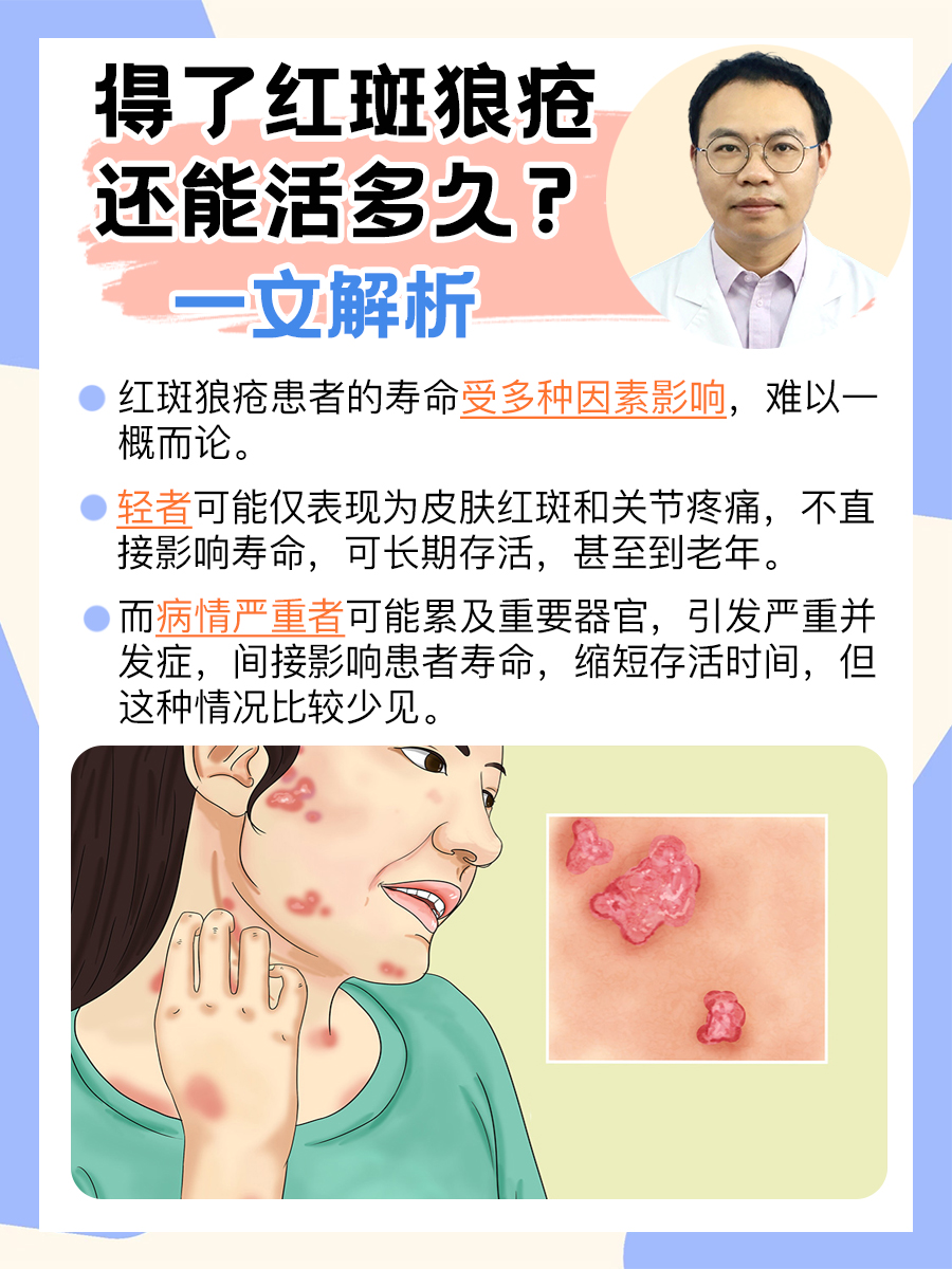 得了红斑狼疮还能活多久？一文解析