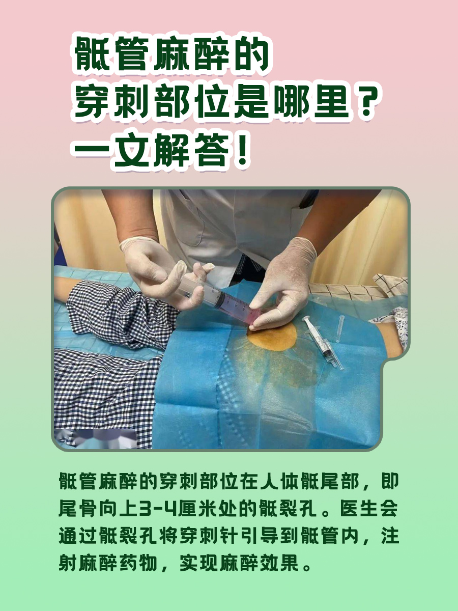 骶管麻醉的穿刺部位是哪里？一文解答！