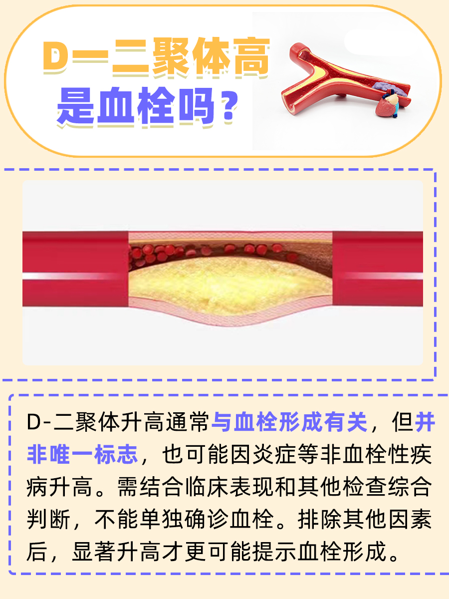 D-二聚体高，这是血栓的信号吗？