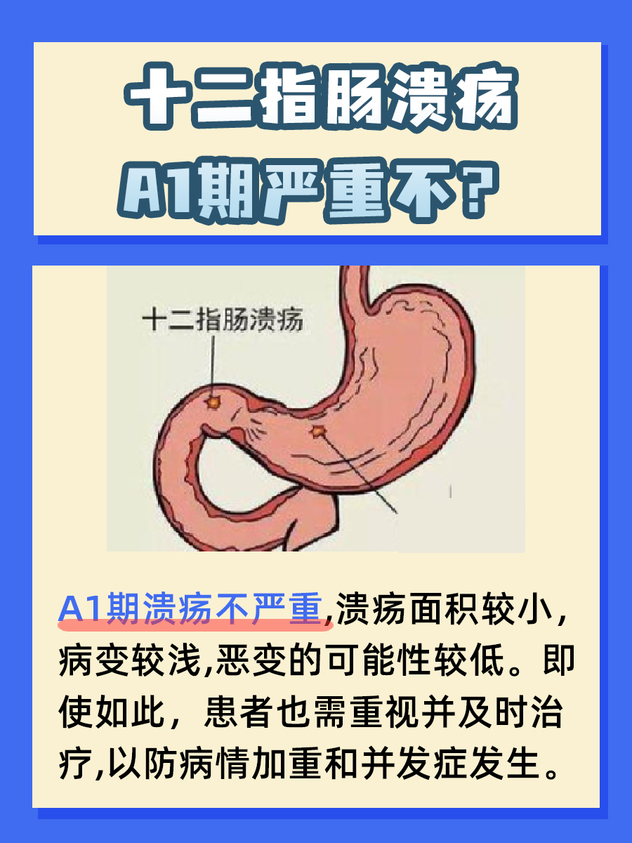 十二指肠溃疡A1期：究竟有多严重？