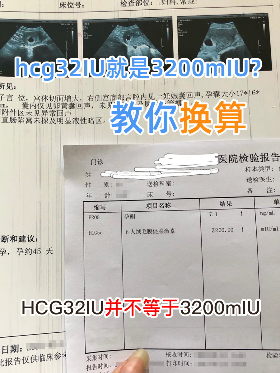 hCG32IU就是3200mIU？教你换算