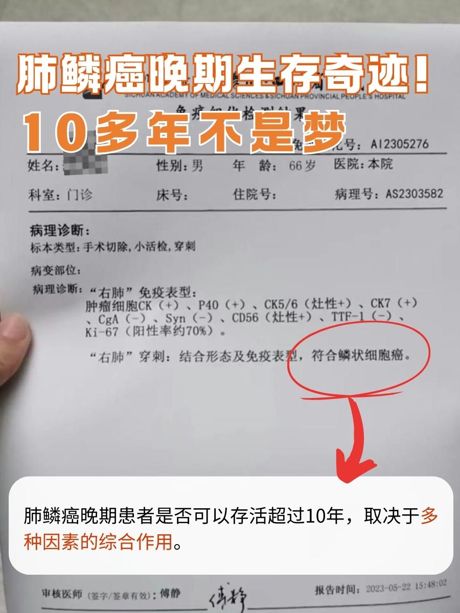 肺鳞癌晚期生存奇迹！10多年不是梦