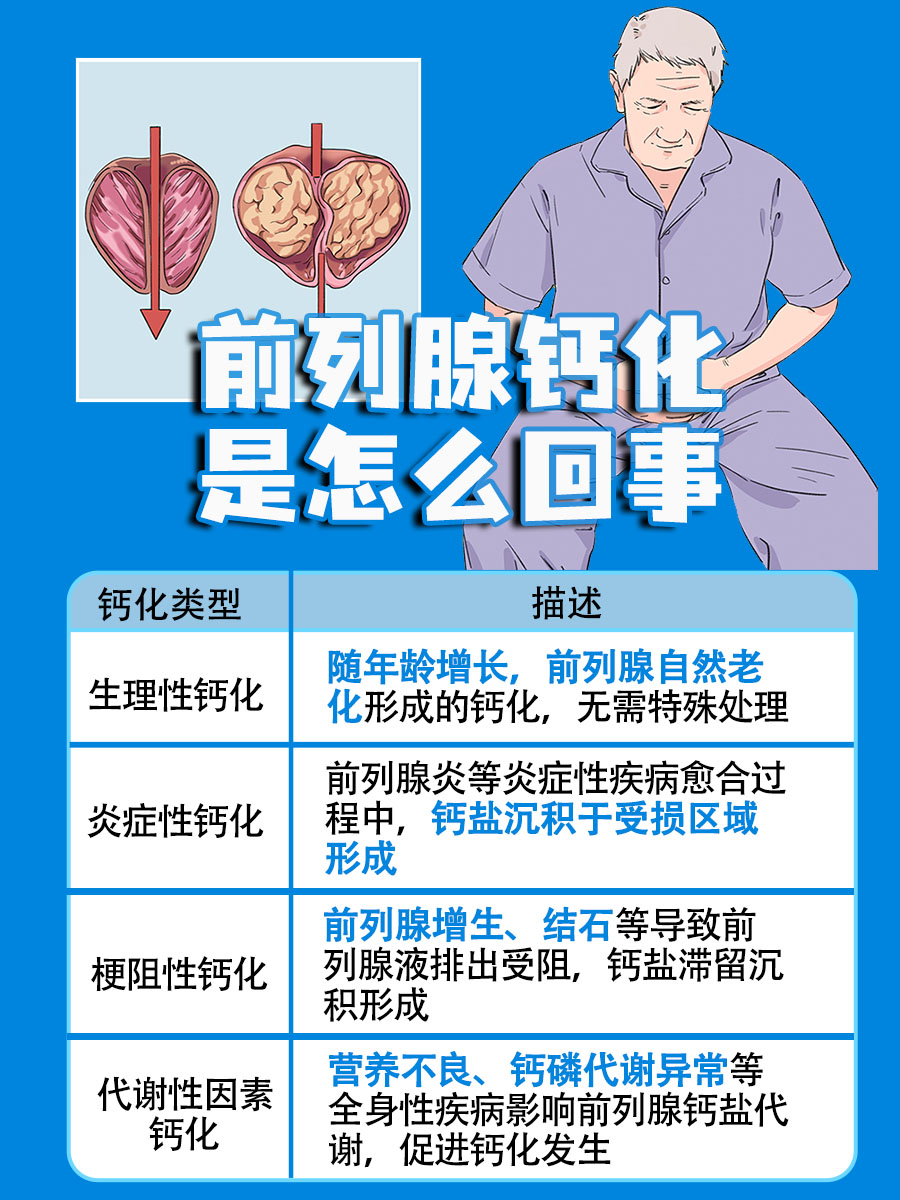 前列腺钙化是怎么回事