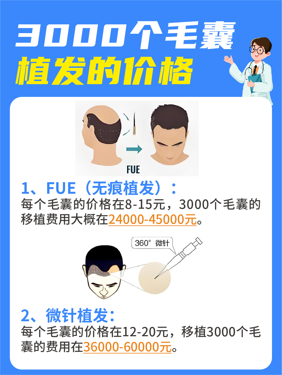 3000个毛囊植发价格，费用明细