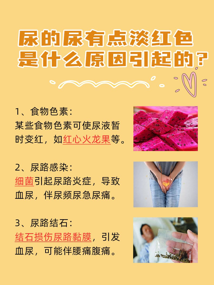 尿的尿有点淡红色：医生告诉你原因