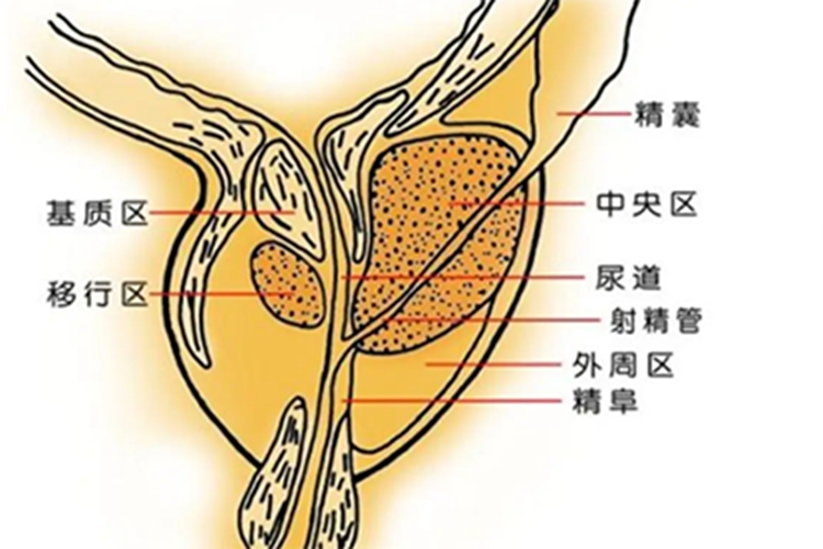 前列腺癌位置图图片
