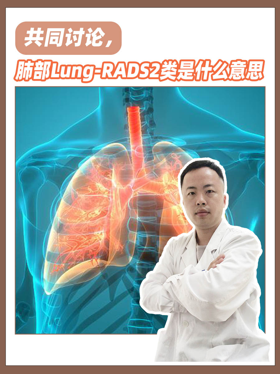 共同讨论，肺部Lung-RADS2类是什么意思