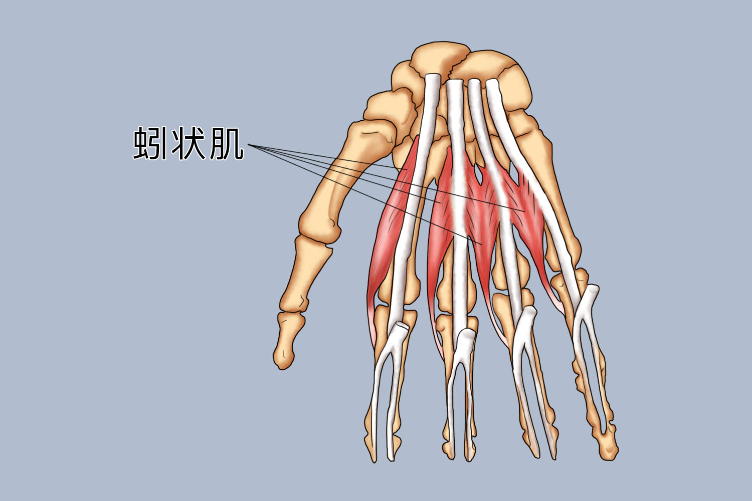 蚓状肌萎缩图片