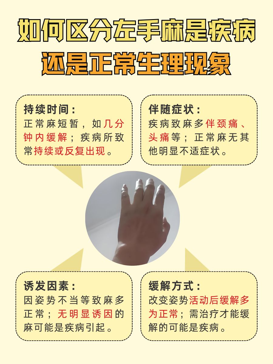 男性左手麻别大意，这些因素你不可不知！