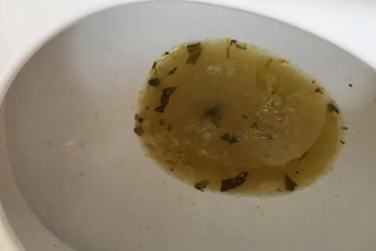 肠炭疽水样便图