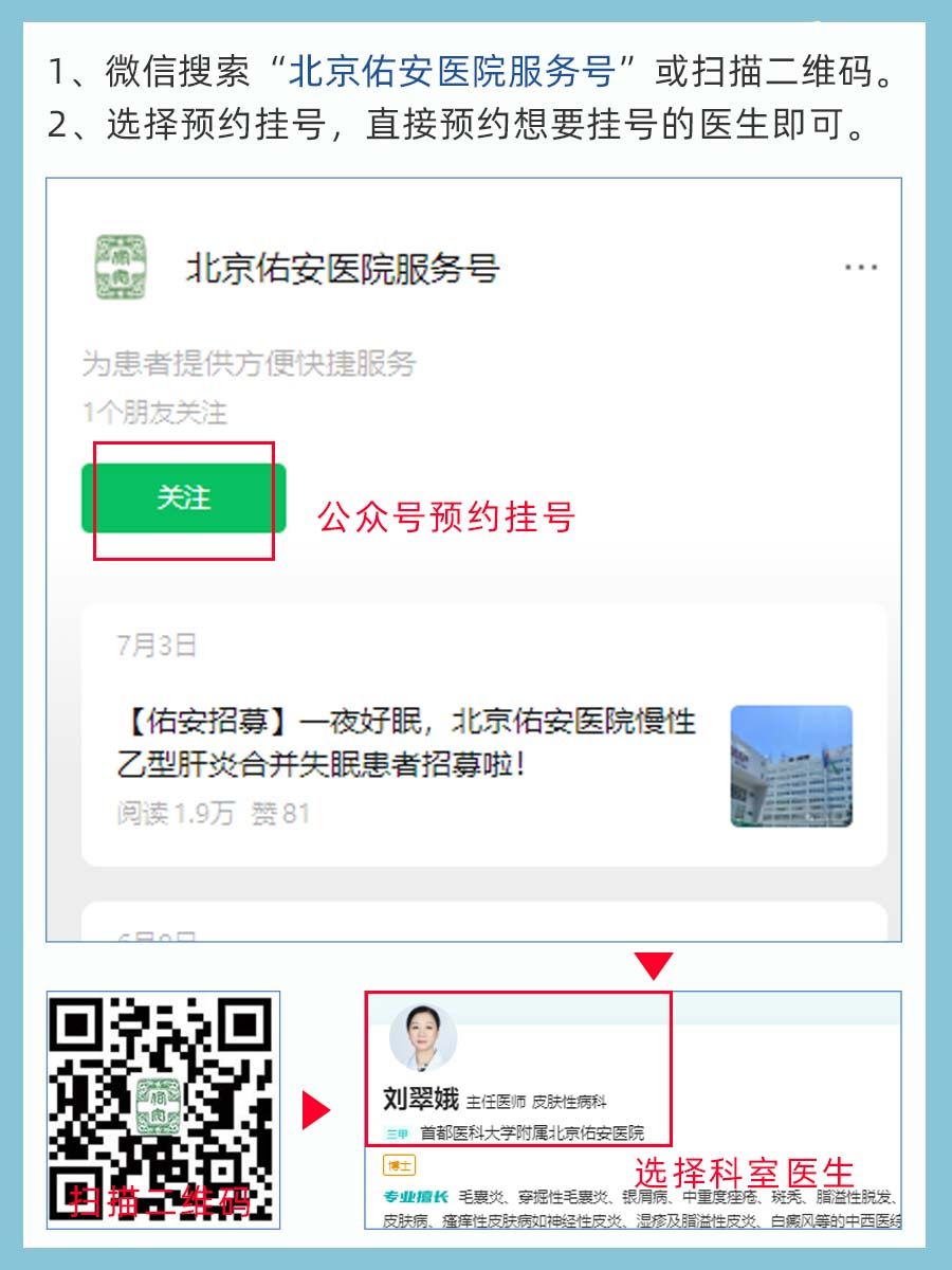 北京佑安医院刘翠娥医生怎么样?怎么挂号?