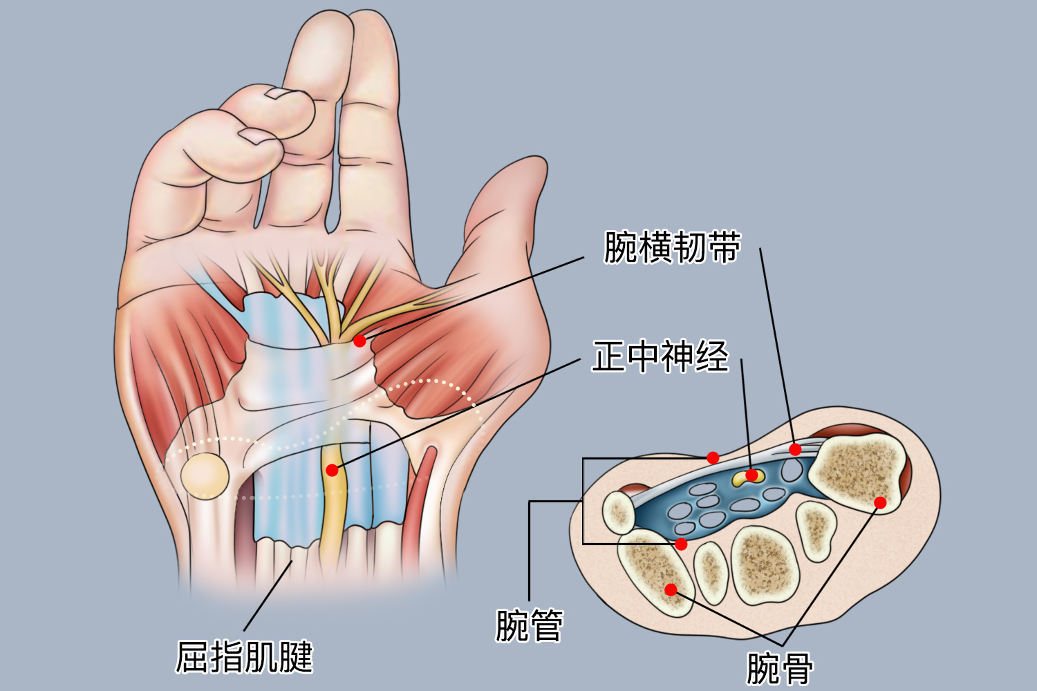 腕部整体图