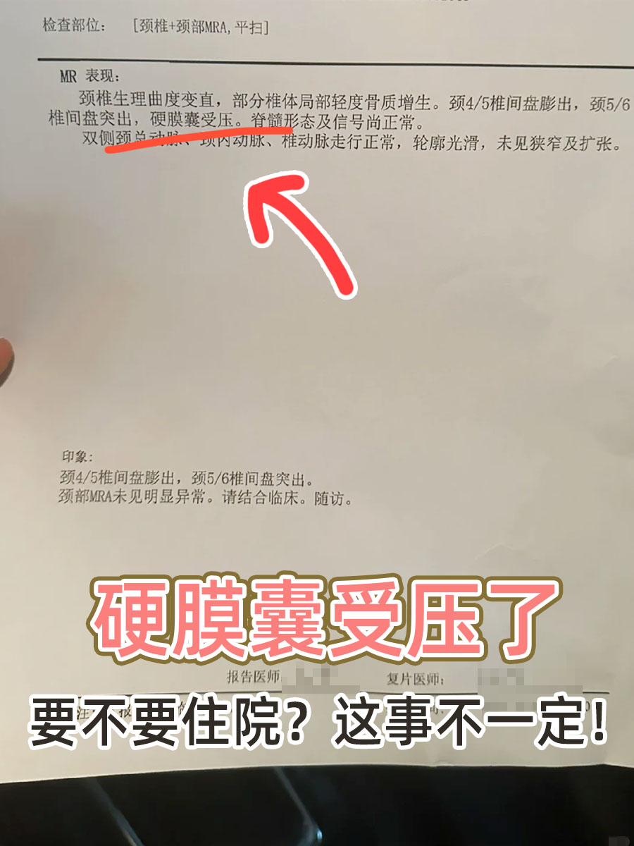 硬膜囊受压于要不要住院?这事不一定!