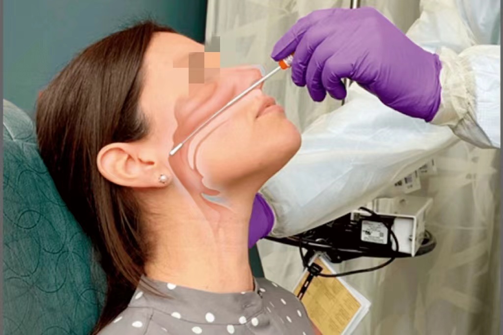 鼻拭子采集方法图