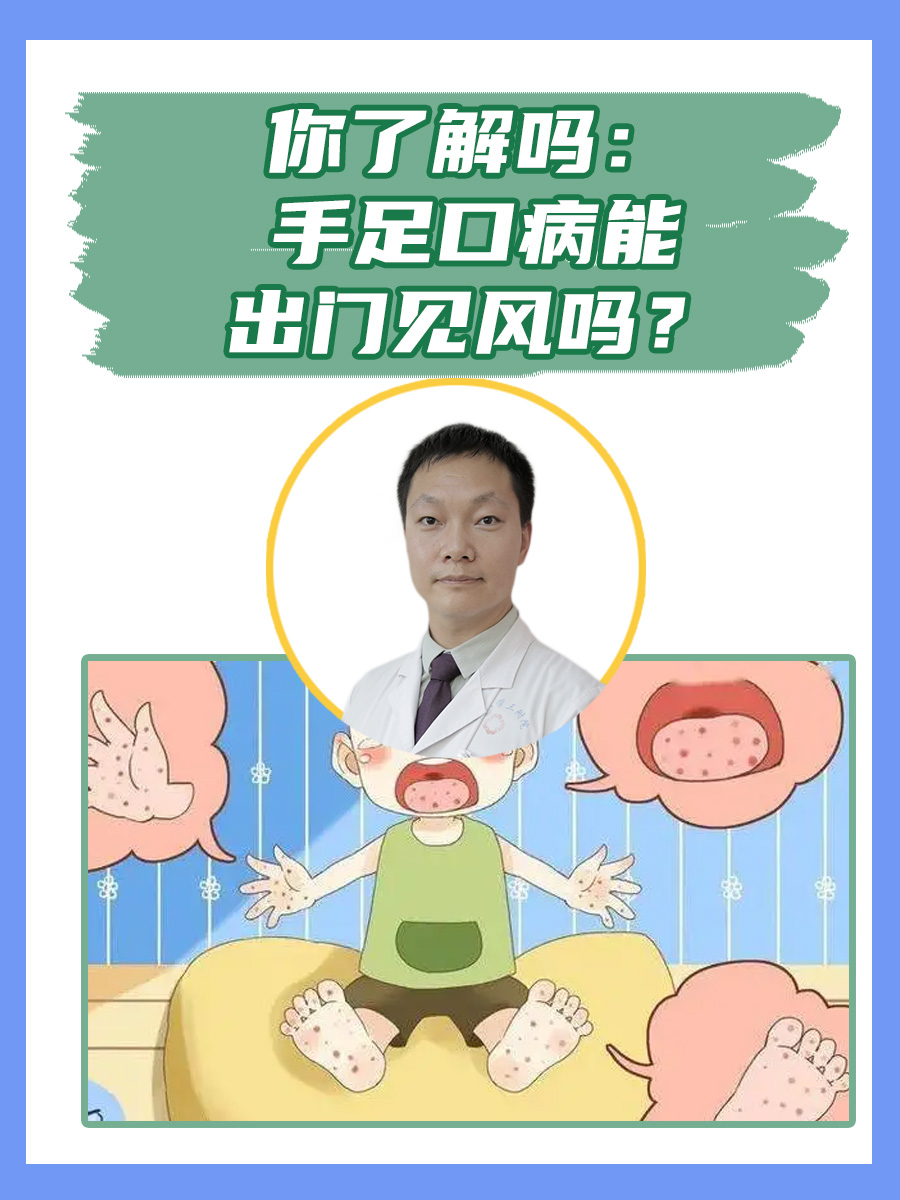 你了解吗：手足口病能出门见风吗？