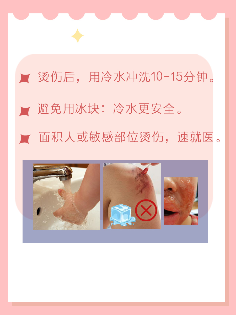 烫伤救星！京万红软膏的正确使用秘籍