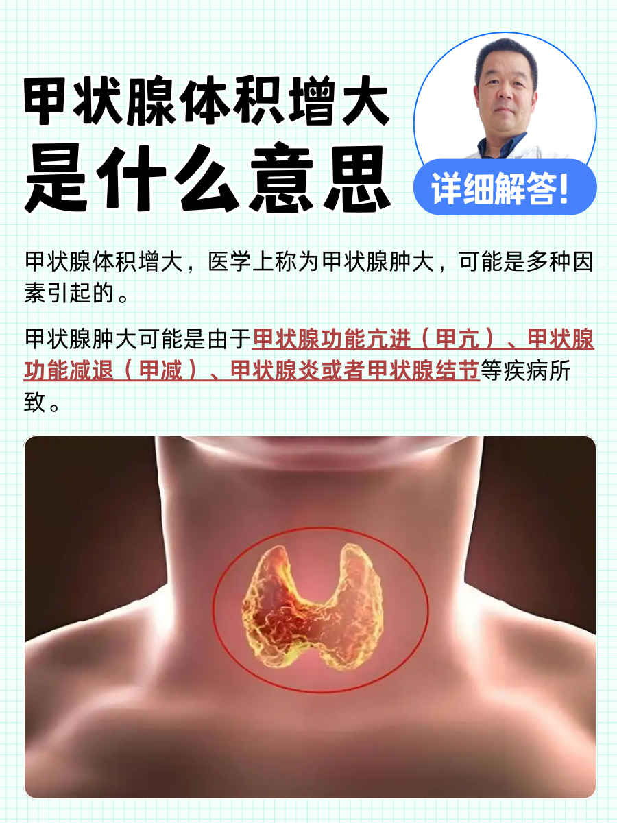 甲状腺体积增大是什么意思,详细解答!