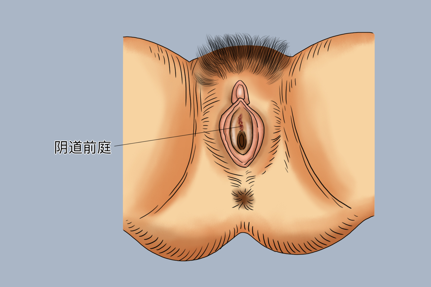 阴道前庭撕裂图 阴道前庭撕裂图