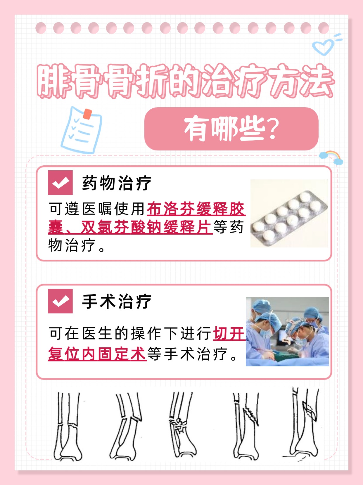 揭秘：腓骨骨折一个月就好了，怎么回事？