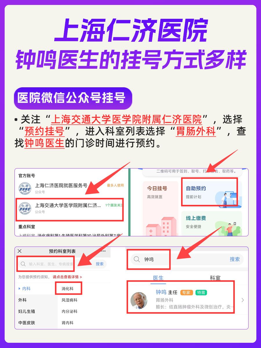 上海仁济医院钟鸣医生怎么样？怎么挂号？