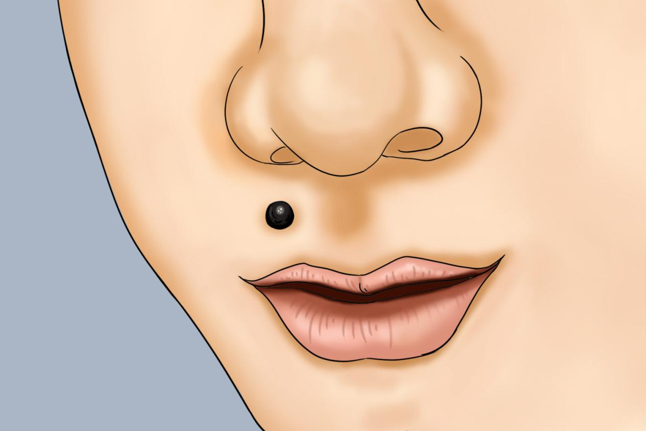 危险三角区痣图