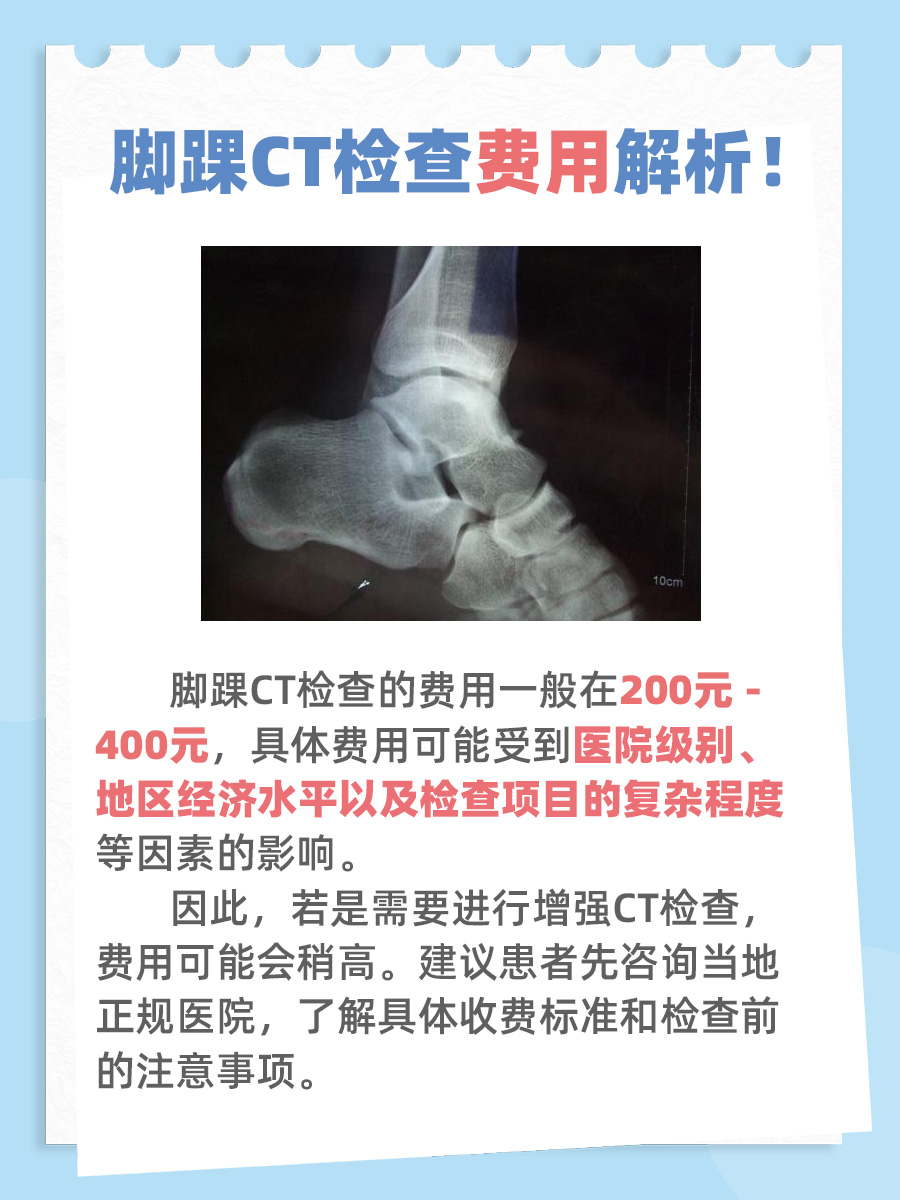 揭秘｜脚踝CT检查一次多少钱？一篇搞懂！