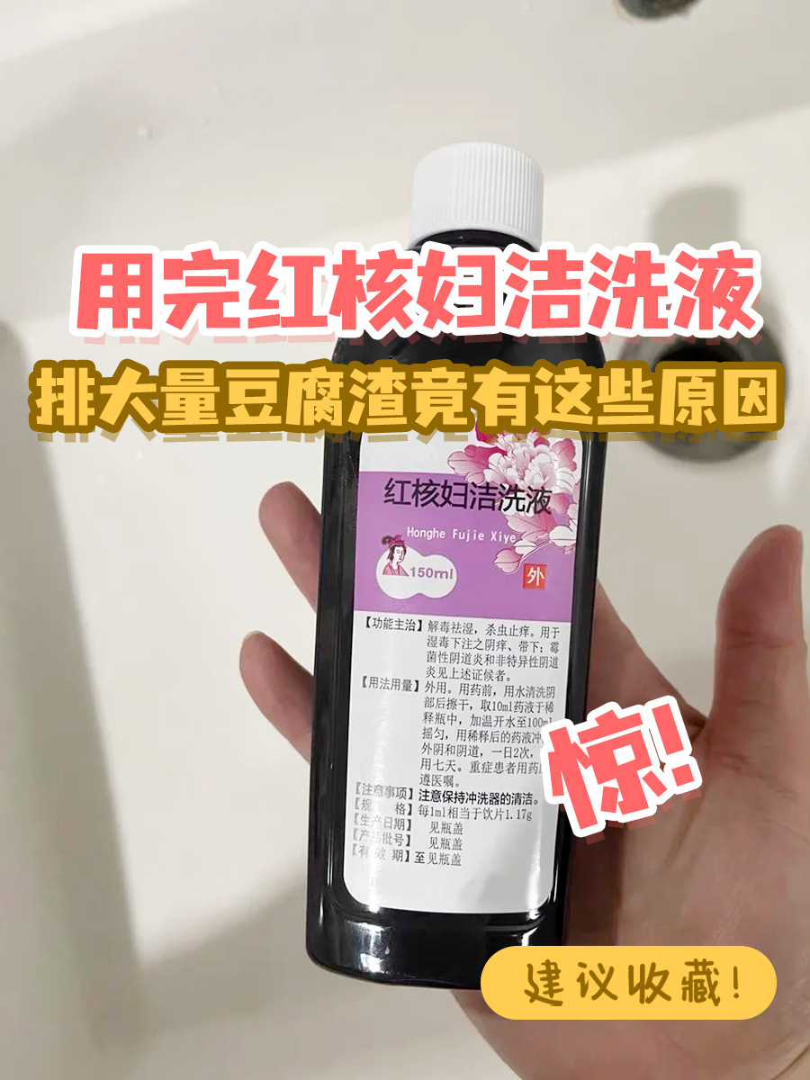 惊！用完红核妇洁洗液排大量豆腐渣竟有这些原因