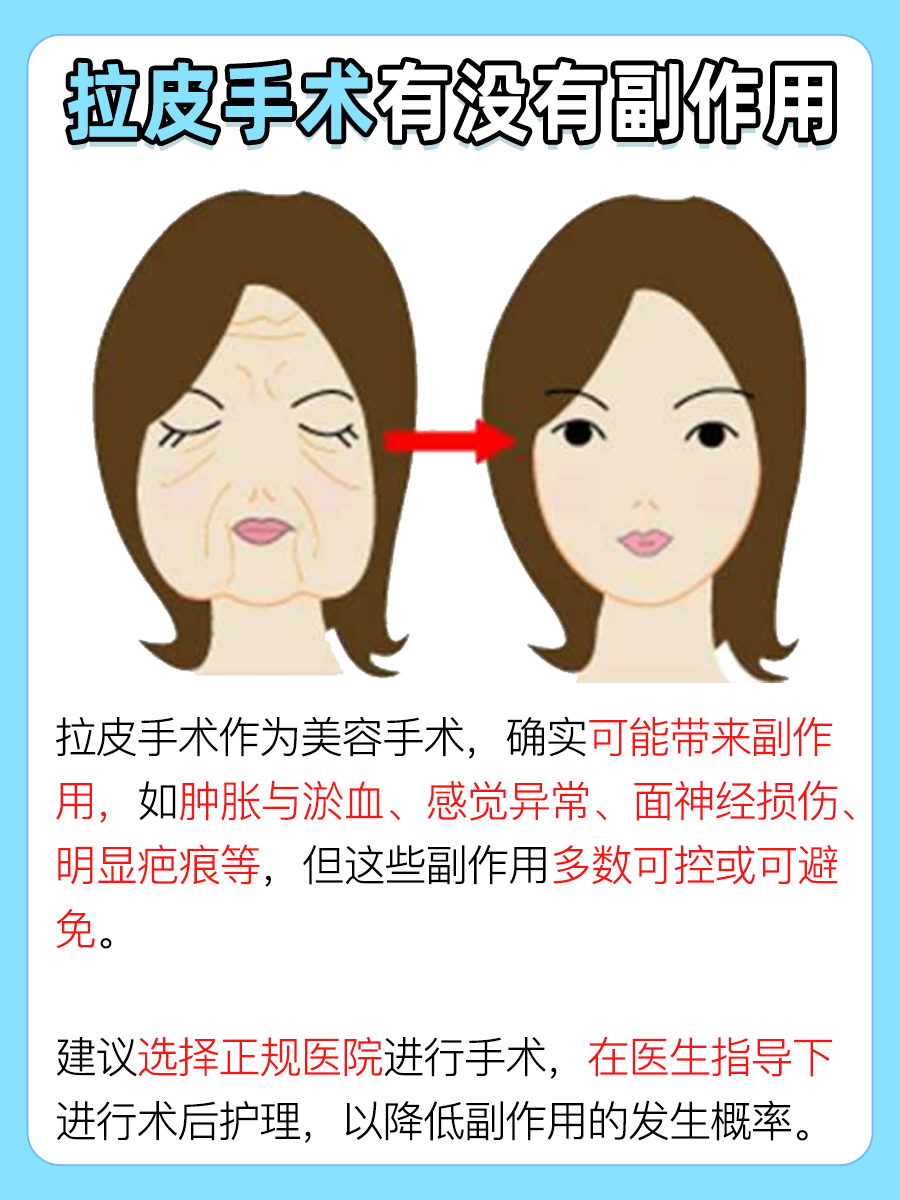 医生带你快速知晓：拉皮手术有没有副作用？