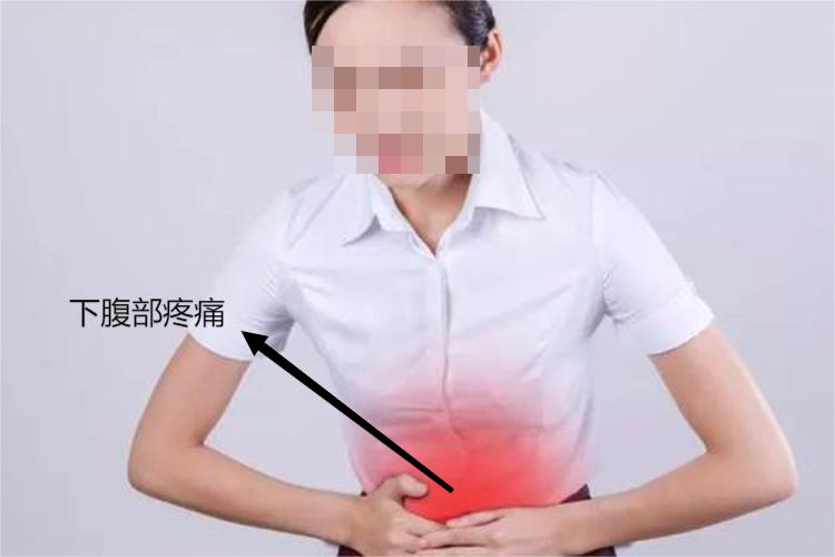 盆腔炎疼痛部位图