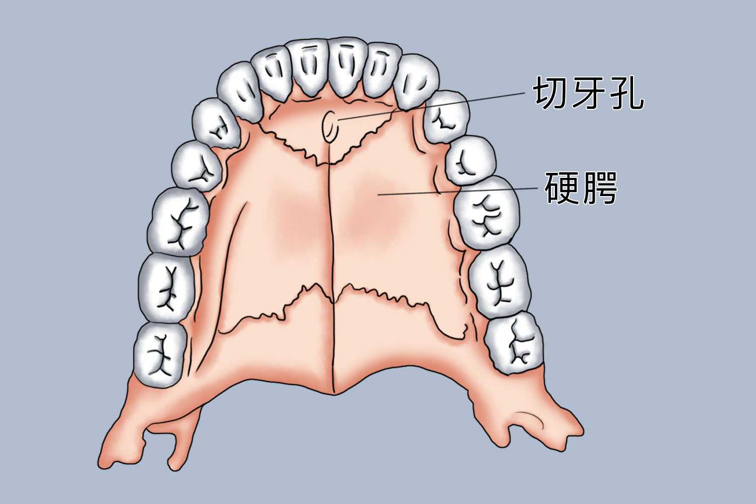 切牙孔位置图 切牙孔位置图