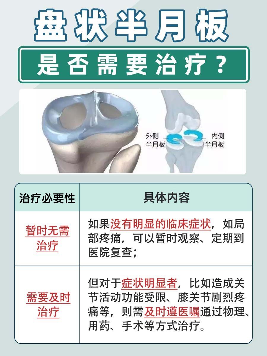 盘状半月板患者必看！是否需要治疗？