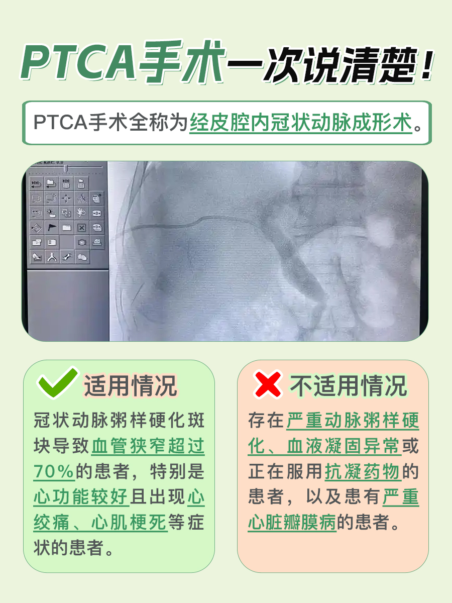 PTCA手术，心血管患者的福音！