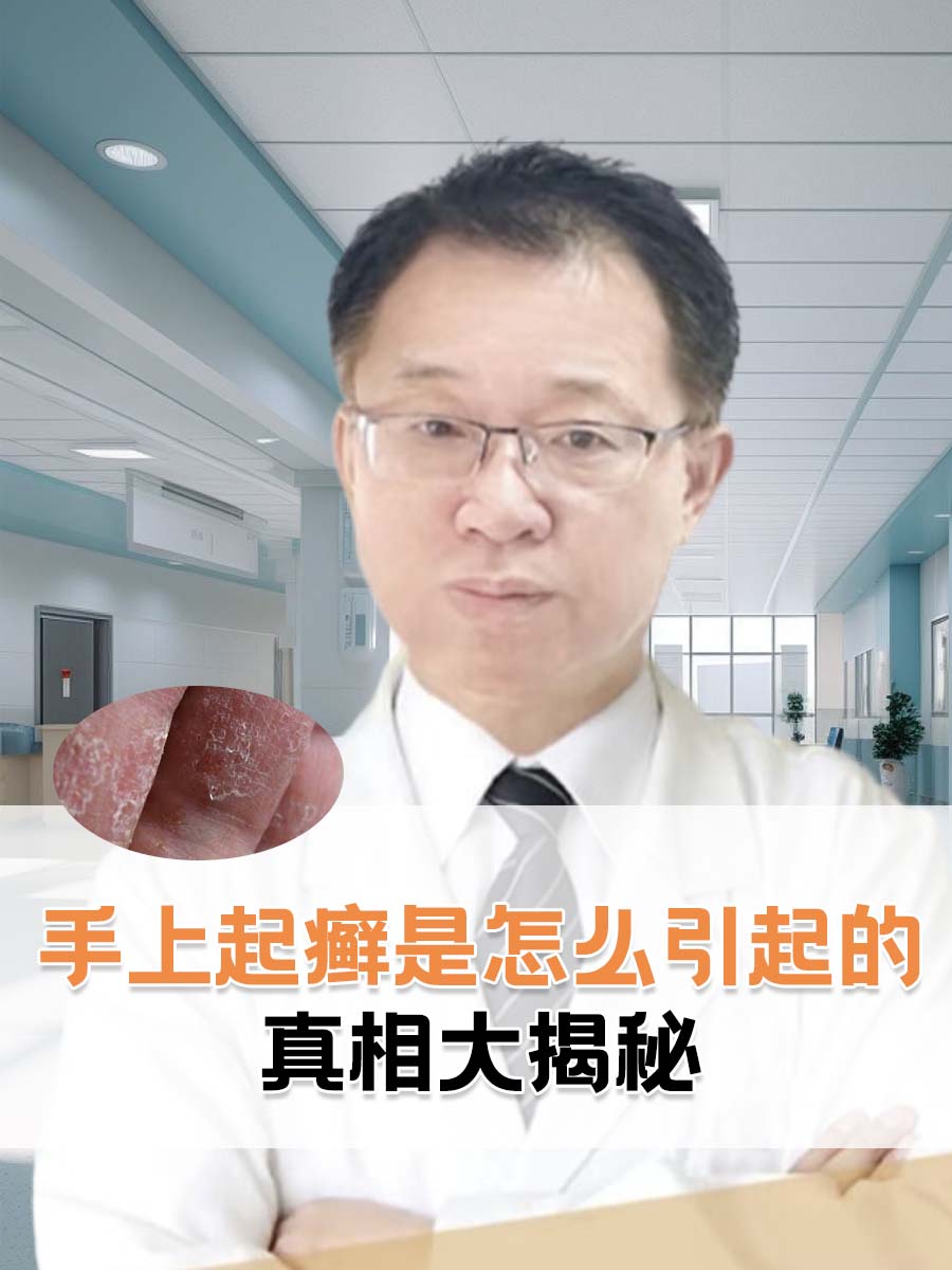 手上起癣是怎么引起的，真相大揭秘