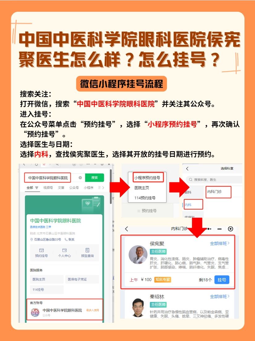中国中医科学院眼科医院侯宪聚医生怎么样？怎么挂号？
