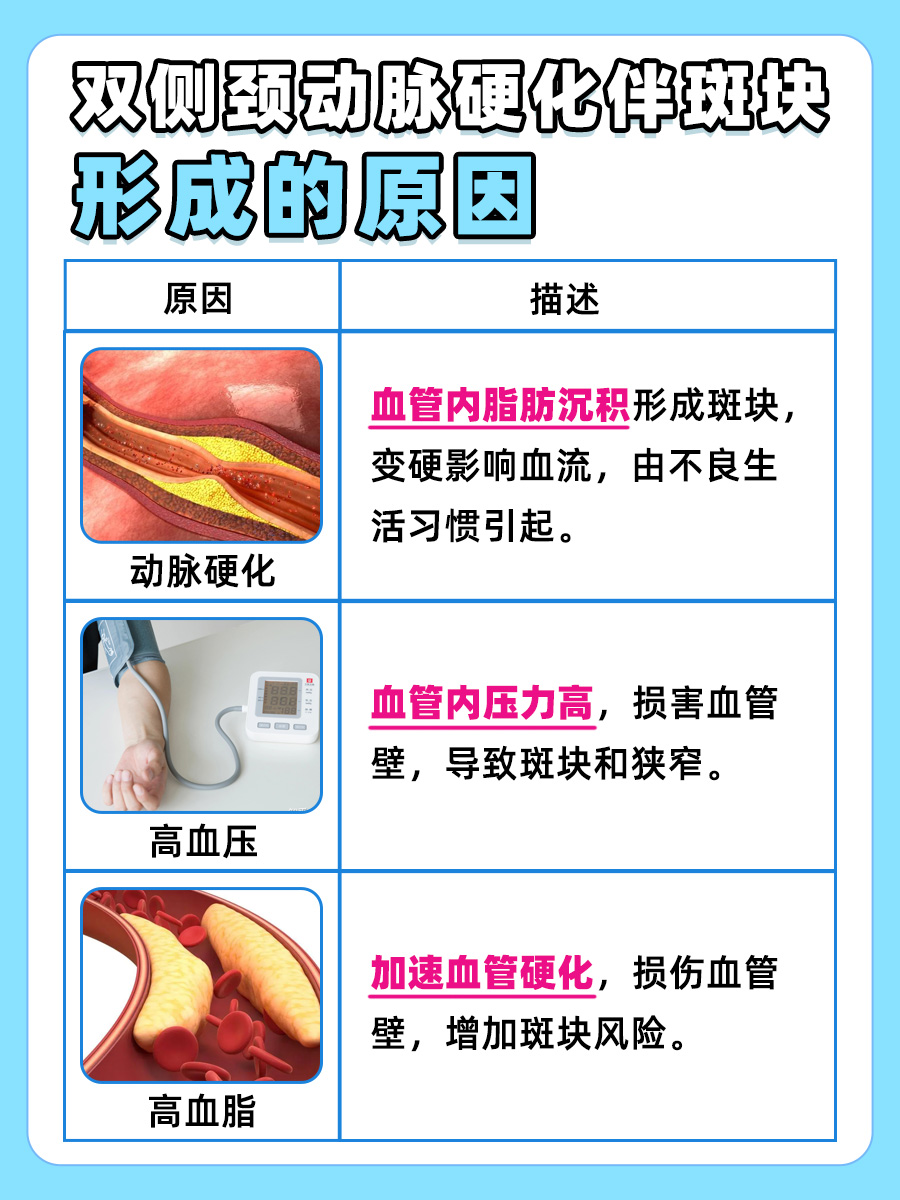 双侧颈动脉硬化及斑块形成的原因与影响解析