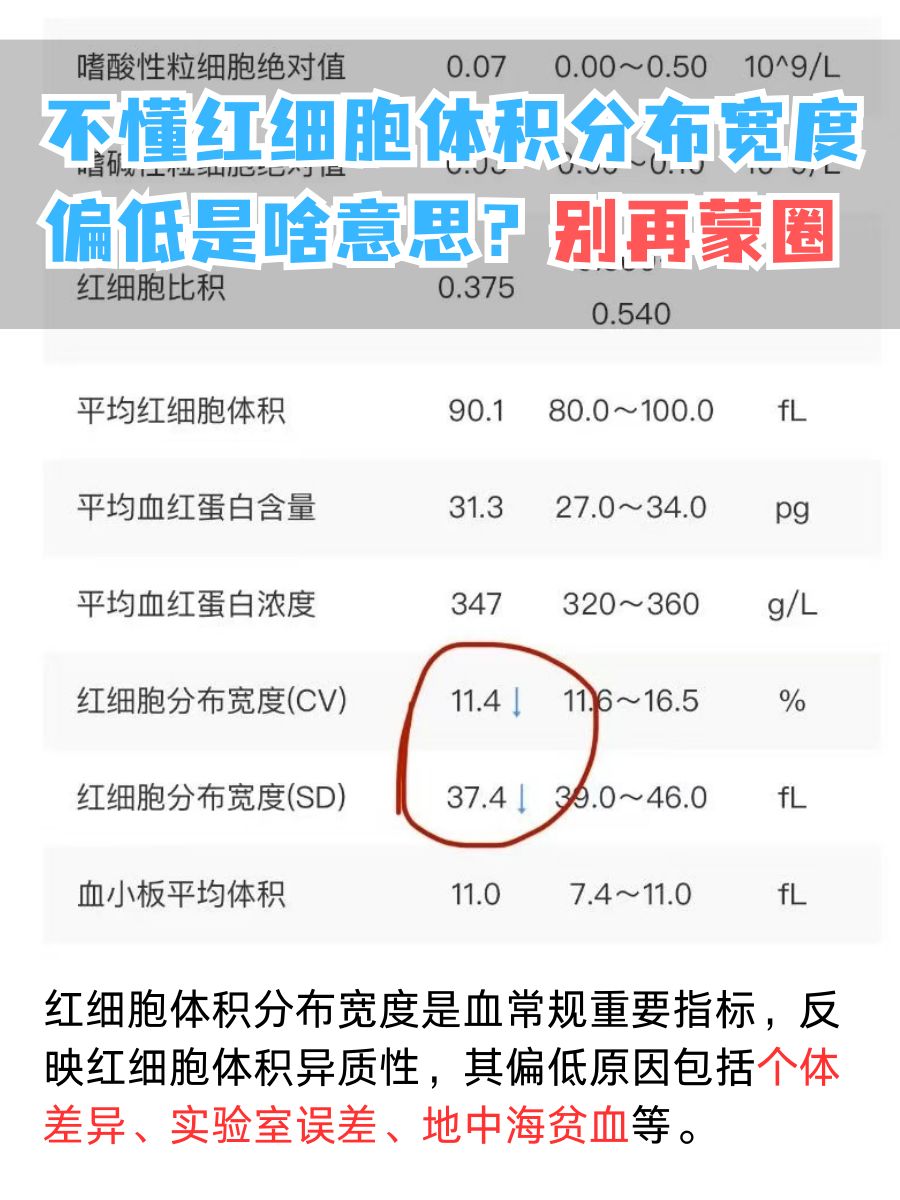 不懂红细胞体积分布宽度偏低是啥意思？别再蒙圈