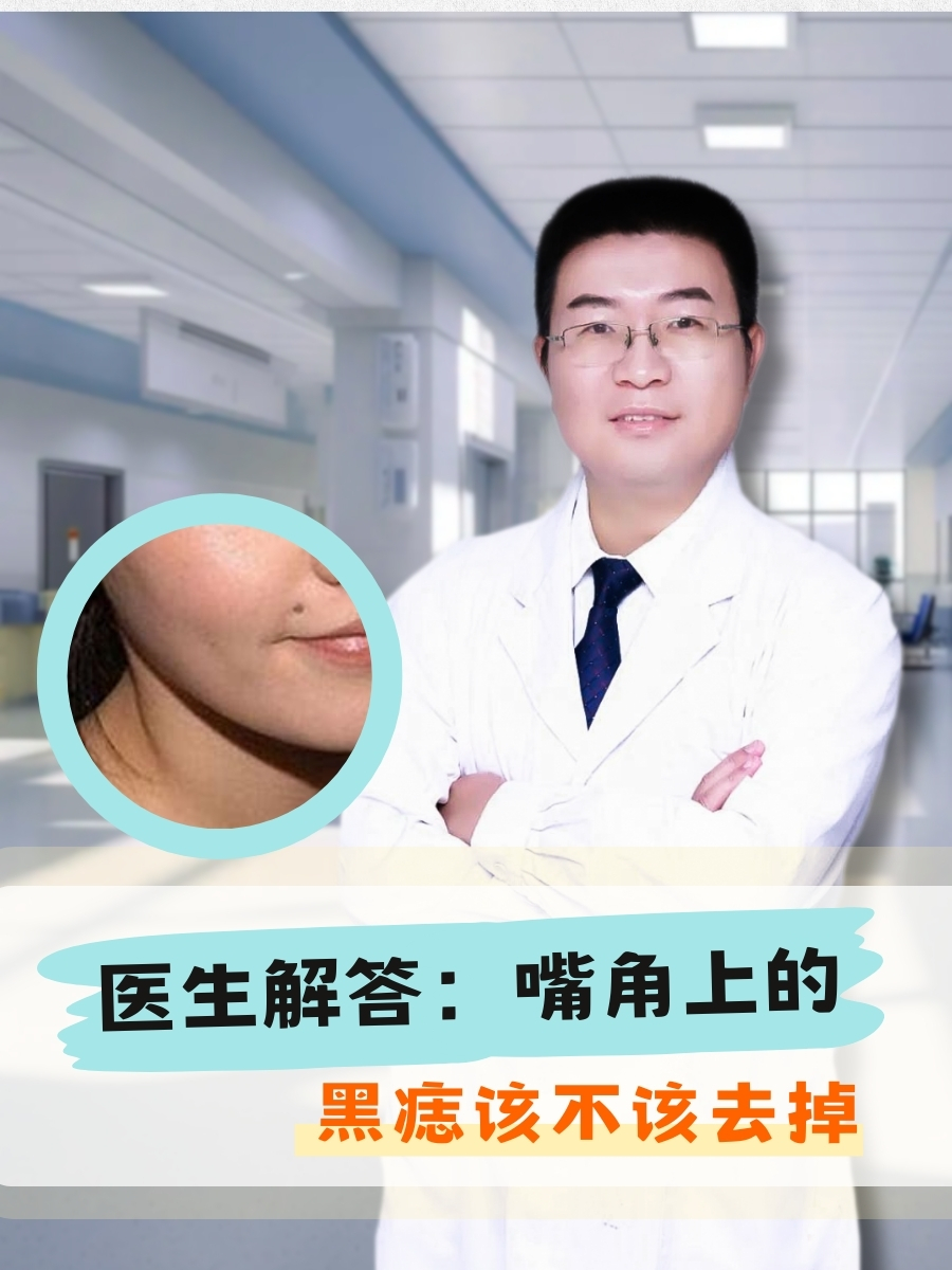 医生解答：嘴角上的黑痣该不该去掉