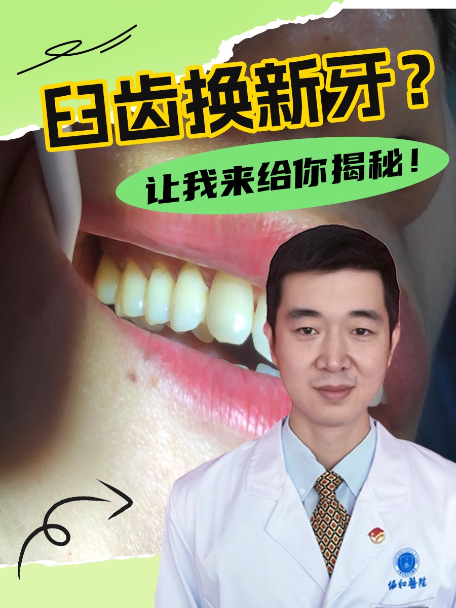 磨牙会换新牙吗？一文说清！
