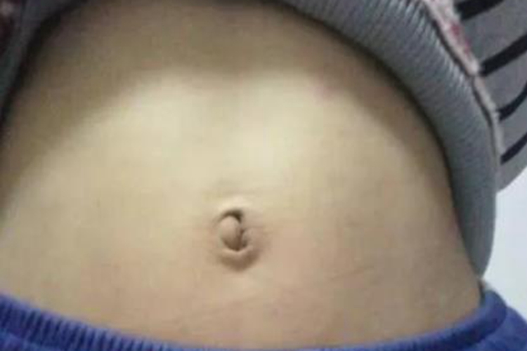 肚脐眼正常情况图
