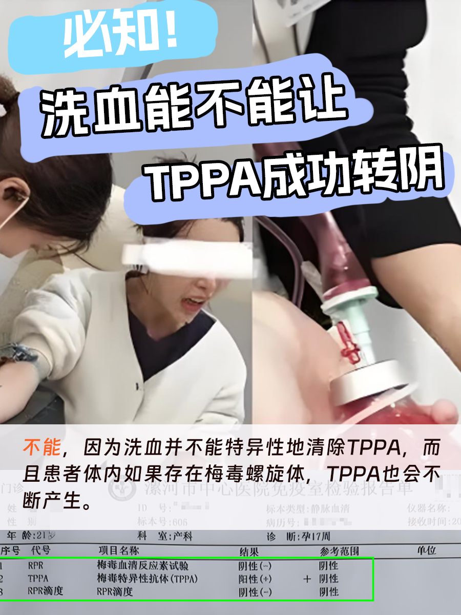 必知!洗血能不能让TPPA成功转阴