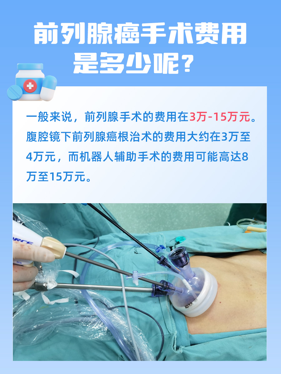 带你了解前列腺癌手术价格