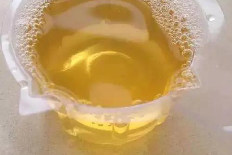 正常新鲜尿液图