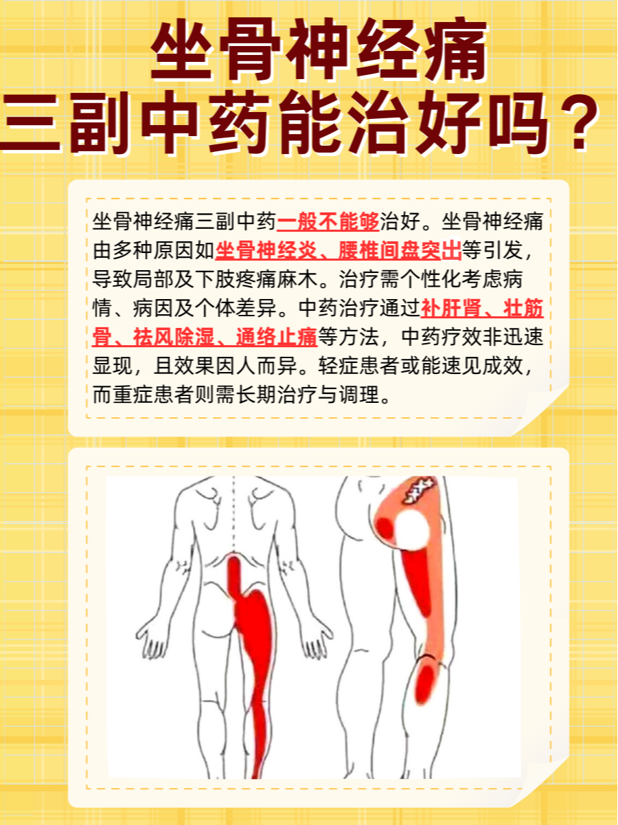 坐骨神经痛三副中药能治好吗？一文解析