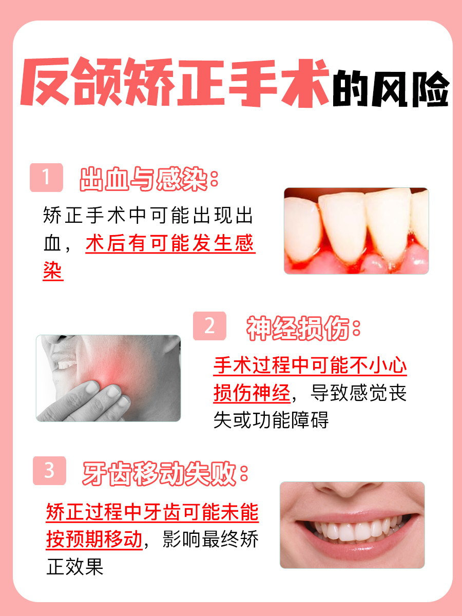 反颌矫正黄金期：把握最佳年龄，改变一生！