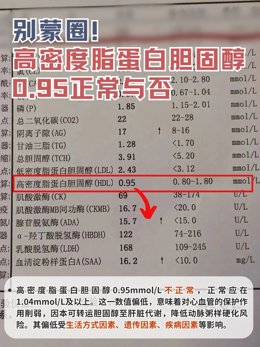 别蒙圈！高密度脂蛋白胆固醇0.95正常与否